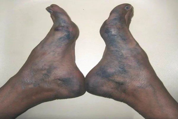 身体出现蓝色汗液的图片