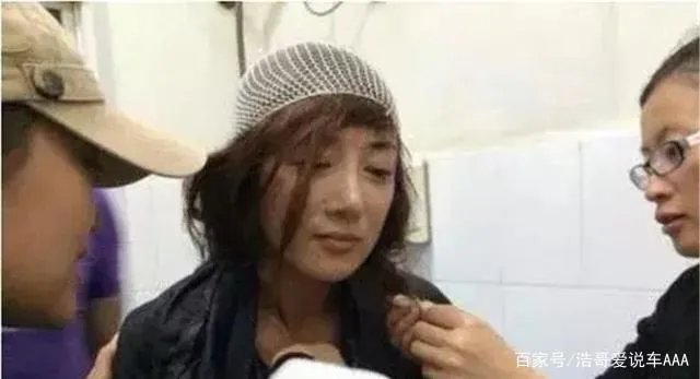 曾被称为“古装第一美人”的她，被狗咬毁容，而如今如何了？