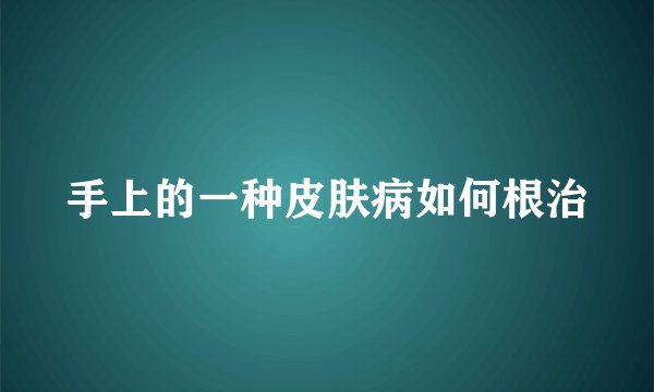 手上的一种皮肤病如何根治