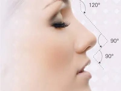 玻尿酸隆鼻整形好不好