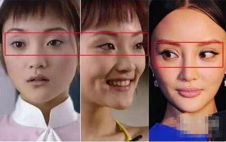 哪些女明星本来很好看却要整容，还越整越丑？