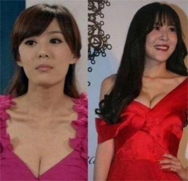 有哪些明星整容整的很失败的案例？