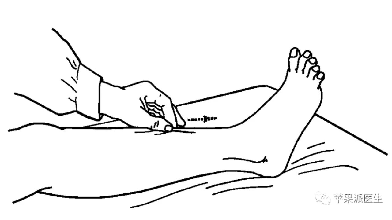 理解Babinski征,划对Babinski征