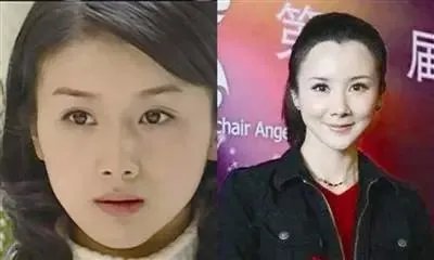哪些女明星本来很好看却要整容，还越整越丑？