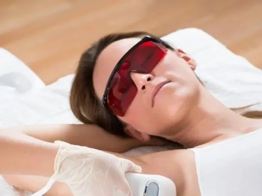 冰点激光脱毛的优势