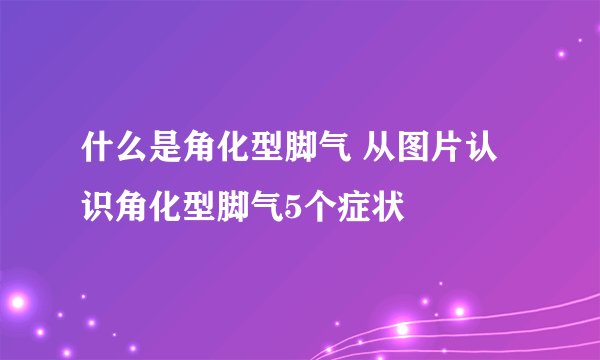 什么是角化型脚气 从图片认识角化型脚气5个症状